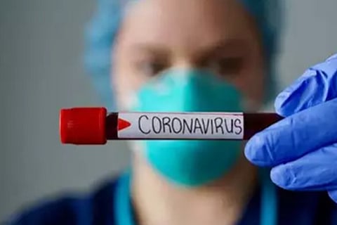 Corna virus 16 April 20