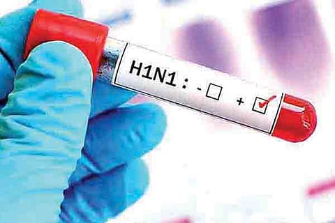 H1N1