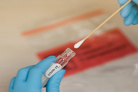 covid-19-swab-sample-test 28 APR 20