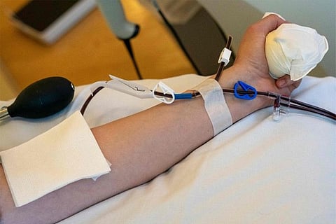 plasma theraphy