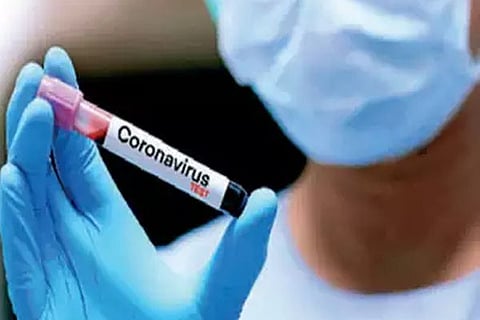 Corona Virus 26 May 20