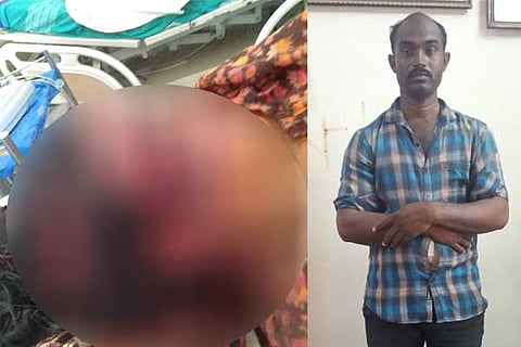 Murder Accused