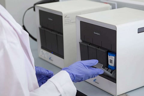 TB test