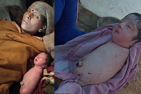 Baby born No Arms