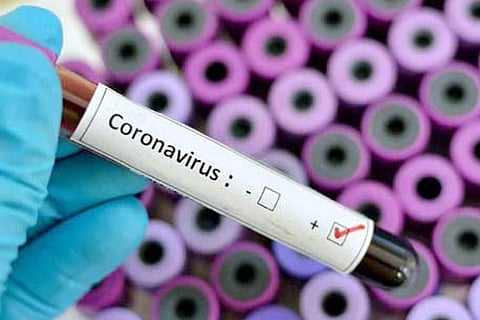 Corona Positive Case - Copy
