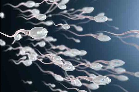 SPERM MM