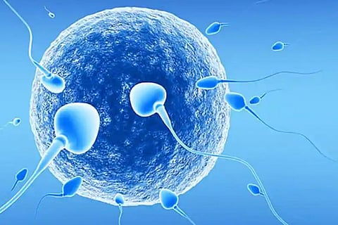 SPerm
