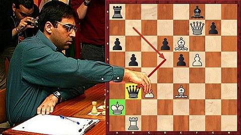 anand1