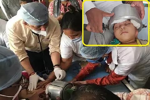 iinfant’s head gets stuck in cooker1