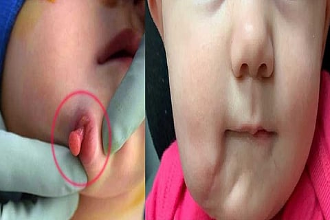 two mouthsweb