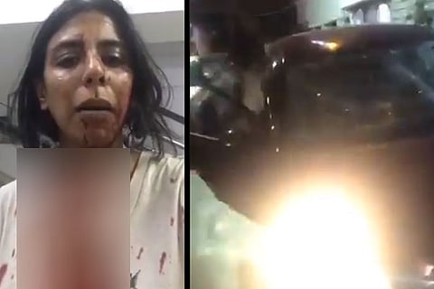Car Accident