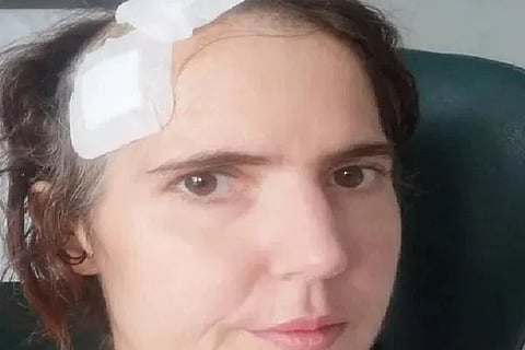 Woman Suffered