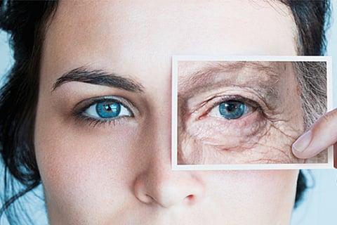 age