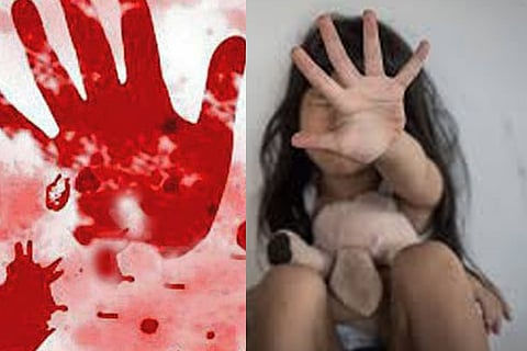 rape