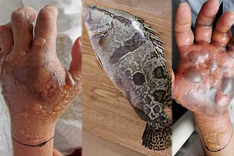 Fishbone