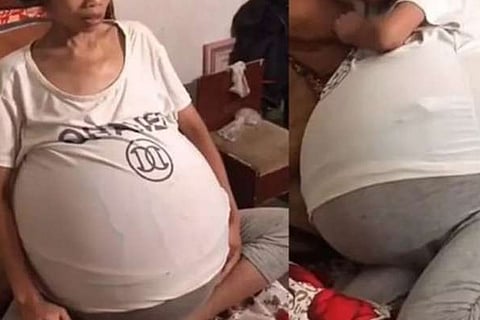 Woman Belly