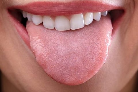 Tongue