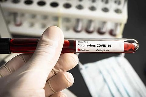 Covid -19