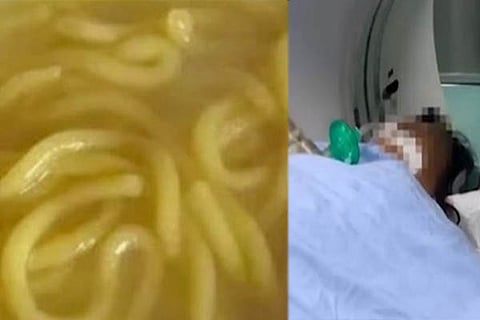 Noodles