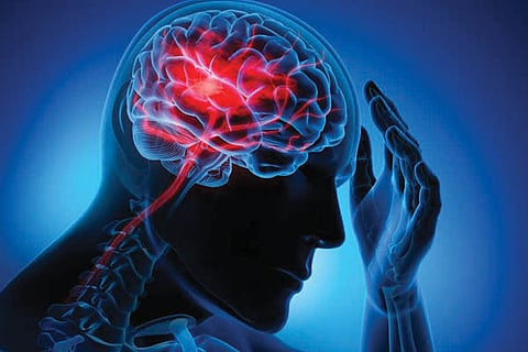 Stroke