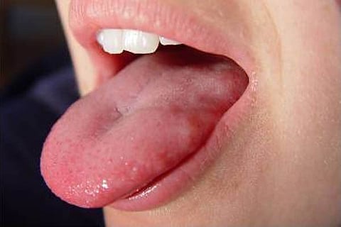 Tounge