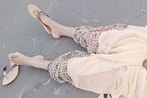 Dead Body