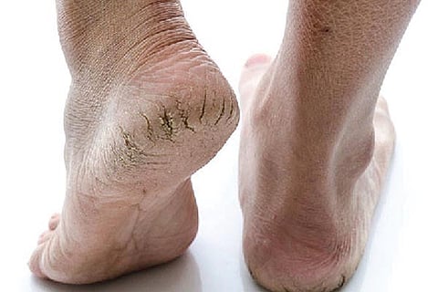 Heel