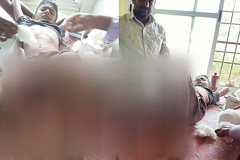 boy Injured 1