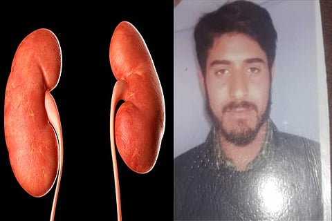 kidney