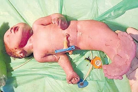 Child 1