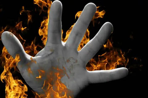 fire