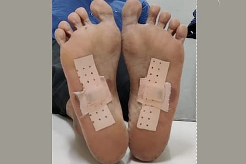 Bandage