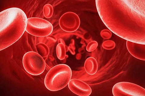 Haemophilia