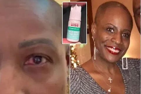 eye drop