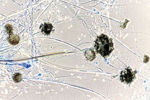 black fungus