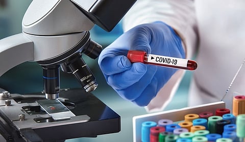 covid-19-coronavirus-test-blood-sample-virus-shut