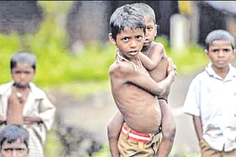 Malnutrition