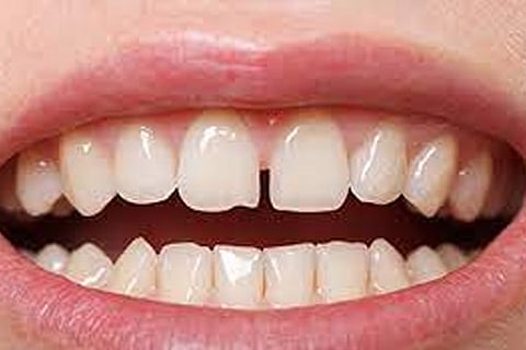 Teeth