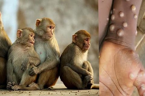 monkey virus