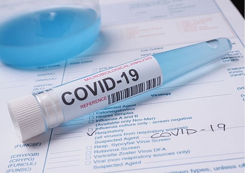 Covid-Test