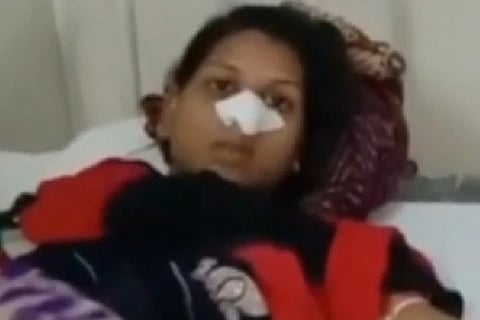 nose