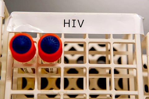 HIV