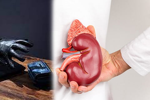 Kidney