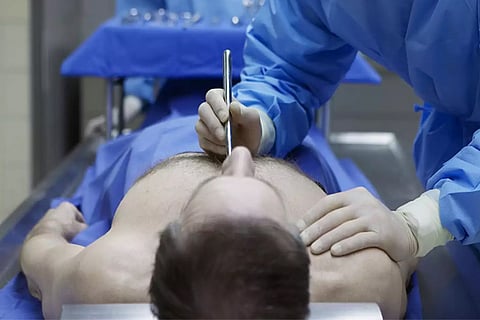 postmortum