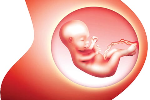 Abortion