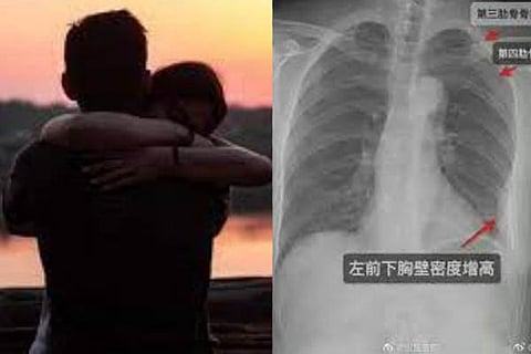 Hug Ribs