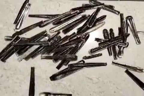 63 steel spoons stomach