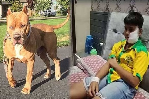 Pitbull