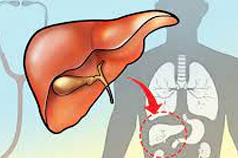 Liver Transplant