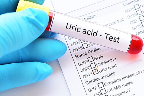 Uric Acid